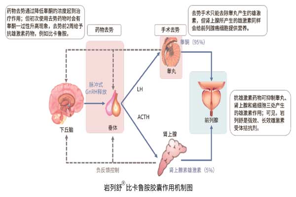 前列腺癌,振东,比卡鲁胺胶囊